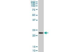 RPS5 monoclonal antibody (M02), clone 4H3 Western Blot analysis of RPS5 expression in HeLa .