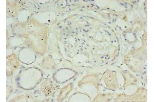Immunohistochemistry of paraffin-embedded human kidney tissue using ABIN7159152 at dilution of 1:100 (MED27 抗体  (AA 67-165))