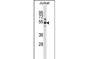 VPS4B Antibody (C-term) (ABIN657734 and ABIN2846719) western blot analysis in Jurkat cell line lysates (35 μg/lane). (VPS4B 抗体  (C-Term))
