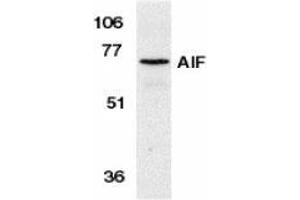 Western blot analysis of AIF in K562 cell lysate with AP30029PU-N AIF antibody at 1 μg/ml. (AIF 抗体  (N-Term))
