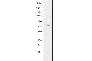 Western blot analysis of IRG1 using LOVO whole  lysates. (IRG1 抗体  (C-Term))