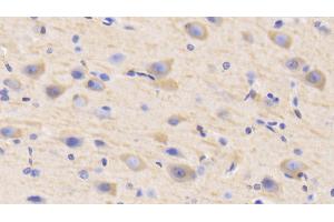 Detection of MAP2 in Human Cerebrum Tissue using Polyclonal Antibody to Microtubule Associated Protein 2 (MAP2) (MAP2 抗体  (AA 727-985))