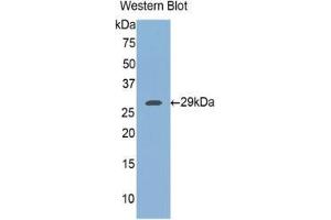 Western blot analysis of the recombinant protein. (FKBP8 抗体  (AA 93-339))