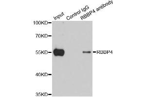 Immunoprecipitation analysis of 200 μg extracts of 293T cells using 1 μg RBBP4 antibody (ABIN5970697). (Retinoblastoma Binding Protein 4 抗体)