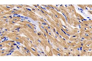 Detection of CYCS in Human Cardiac Muscle Tissue using Monoclonal Antibody to Cytochrome C (CYCS)