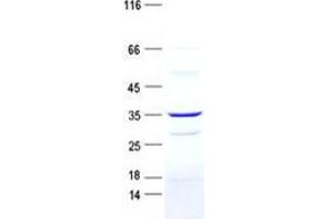 Western Blotting (WB) image for Chromosome 15 Open Reading Frame 48 (C15ORF48) protein (GST tag,His tag) (ABIN5505596)
