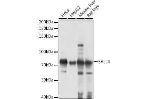 Western blot analysis of extracts of various cell lines, using S antibody (ABIN7270138) at 1:1000 dilution. (SALL4 抗体  (AA 853-1053))