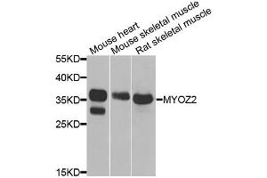 Western blot analysis of extracts of various cell lines, using MYOZ2 antibody. (MYOZ2 抗体)