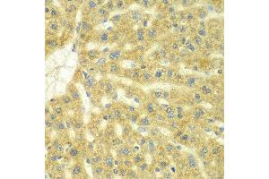 Immunohistochemistry of paraffin-embedded rat liver using ADCK3 antibody at dilution of 1:100 (x40 lens). (COQ8A 抗体)