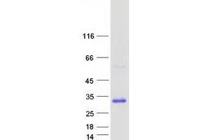 Western Blotting (WB) image for RAB33A, Member RAS Oncogene Family (RAB33A) protein (Myc-DYKDDDDK Tag) (ABIN2730328)