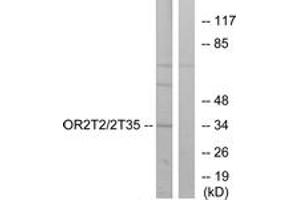Western blot analysis of extracts from HepG2 cells, using OR2T2/2T35 Antibody. (OR2T2/2T35 抗体  (AA 61-110))