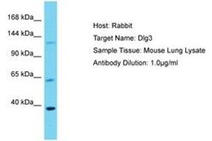 Image no. 1 for anti-Discs, Large Homolog 3 (DLG3) (AA 201-250) antibody (ABIN6750501) (DLG3 抗体  (AA 201-250))