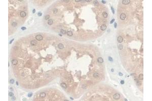 Detection of GREM1 in Human Kidney Tissue using Monoclonal Antibody to Gremlin 1 (GREM1) (GREM1 抗体  (AA 26-184))