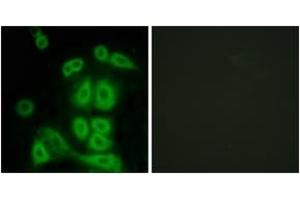 Immunofluorescence analysis of A549 cells, using FXR2 Antibody. (FXR2 抗体  (AA 551-600))