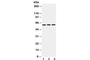 Western blot testing of 1) rat brain, 2) mouse NIH3T3 and 3) human HepG2 lysate with Cytokeratin 14 antibody at 0.