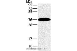 Western blot analysis of Mouse brain tissue, using PPP1CC Polyclonal Antibody at dilution of 1:200 (PPP1CC 抗体)