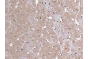 DAB staining on IHC-P; Samples: Rat Heart Tissue (Ninein 抗体  (AA 1-153))