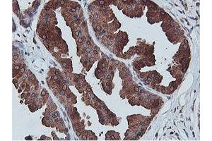 Immunohistochemical staining of paraffin-embedded Human breast tissue using anti-C20orf3 mouse monoclonal antibody. (APMAP 抗体)
