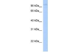 LRRC8A antibody used at 1 ug/ml to detect target protein. (LRRC8A 抗体  (N-Term))