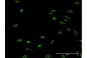 Immunofluorescence of monoclonal antibody to FOXL1 on HeLa cell. (FOXL1 抗体  (AA 132-240))