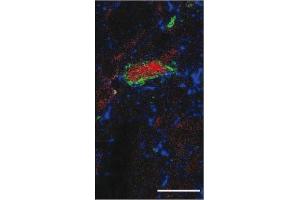 Immunofluorescence image of Substance P staining in vibratome section of rat spinal cord. (Substance P 抗体)