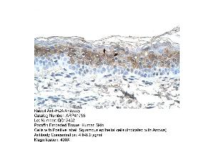 Rabbit Anti-FGA Antibody  Paraffin Embedded Tissue: Human Skin Cellular Data: Squamous epithelial cells Antibody Concentration: 4. (FGA 抗体  (N-Term))