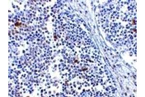 Immunohistochemistry (IHC) image for anti-Interferon Induced with Helicase C Domain 1 (IFIH1) (Middle Region) antibody (ABIN1031000) (IFIH1 抗体  (Middle Region))