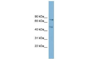 BOP1 antibody used at 1 ug/ml to detect target protein. (BOP1 抗体  (N-Term))