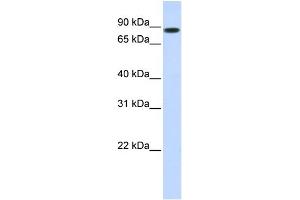WB Suggested Anti-STAT5B Antibody Titration: 1 ug/ml Positive Control: 293T cells lysate There is BioGPS gene expression data showing that STAT5B is expressed in HEK293T (STAT5B 抗体  (N-Term))