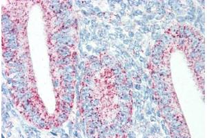 Human Uterus (formalin-fixed, paraffin-embedded) stained with HSPD1 antibody ABIN334251 at 5 ug/ml followed by biotinylated anti-mouse IgG secondary antibody ABIN481714, alkaline phosphatase-streptavidin and chromogen. (HSPD1 抗体)