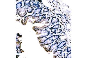 IHC analysis of KLF4 using anti-KLF4 antibody (ABIN7599343). (KLF4 抗体  (AA 1-389))