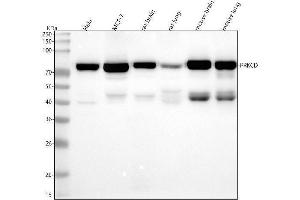 Western blot analysis of PRKCD using anti-PRKCD antibody (ABIN7605966).