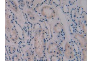 DAB staining on IHC-P; Samples: Human Kidney Tissue (Vip 抗体  (AA 29-165))