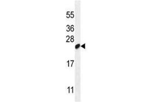 LOC147646 antibody western blot analysis in WiDr lysate. (C19orf84 抗体  (AA 147-176))