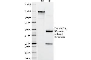 SDS-PAGE Analysis Purified CD22 Mouse Monoclonal Antibody (FR10B4). (CD22 抗体)