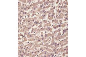 (ABIN652227 and ABIN2840949) staining TTR in human liver tissue sections by Immunohistochemistry (IHC-P - paraformaldehyde-fixed, paraffin-embedded sections). (TTR 抗体  (C-Term))