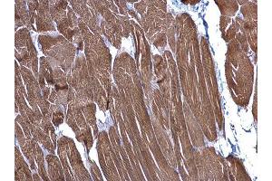 Immunohistochemistry (IHC) image for anti-Actin, Alpha, Cardiac Muscle 1 (ACTC1) antibody (ABIN2855222)