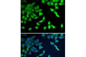 Immunofluorescence analysis of A-549 cells using WDR77 Polyclonal Antibody (WDR77 抗体)