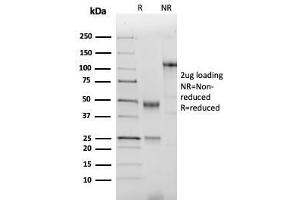 SDS-PAGE Analysis of Purified NKX2. (Nkx2-2 抗体  (AA 1-119))
