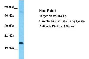Host: Rabbit  Target Name: INSL5  Sample Tissue: Fetal Lung lysates  Antibody Dilution: 1. (INSL5 抗体  (Middle Region))