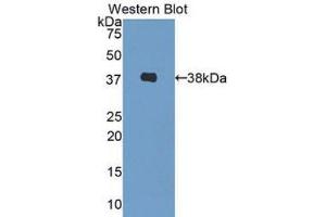 Western Blotting (WB) image for anti-Decorin (DCN) (AA 31-359) antibody (ABIN1175530) (Decorin 抗体  (AA 31-359))