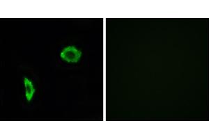 Immunofluorescence analysis of LOVO cells, using Prostacyclin Receptor antibody. (Prostacyclin Receptor 抗体)