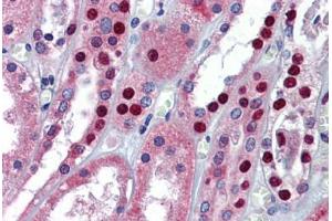 Human Kidney: Formalin-Fixed, Paraffin-Embedded (FFPE) (MPDZ 抗体  (AA 1691-1740))