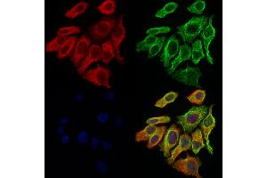 ABIN6261858 and ABIN6276889 staining Hela cells by IF/ICC. (GABRA2 抗体  (N-Term))