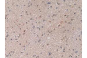 IHC-P analysis of Human Brain Tissue, with DAB staining. (HSP70 1A 抗体  (AA 285-641))