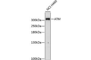 Western blot analysis of extracts of H460 cells, using ATM Antibody (ABIN6133566, ABIN6137281, ABIN6137282 and ABIN6221615) at 1:1000 dilution. (ATM 抗体  (AA 1900-2000))