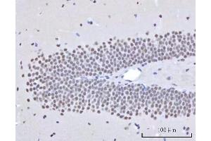 IHC analysis of RBM22 using anti-RBM22 antibody (ABIN7600268).