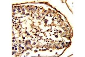 Immunohistochemistry (IHC) image for anti-Tubulin, beta 1 (TUBB1) antibody (ABIN3029340)