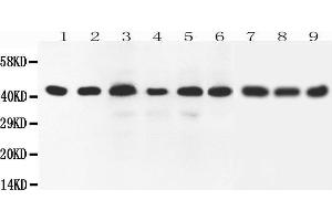 Western Blotting (WB) image for anti-SRY (Sex Determining Region Y)-Box 7 (SOX7) (AA 370-388), (C-Term) antibody (ABIN3042550) (SOX7 抗体  (C-Term))