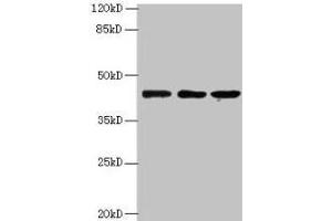 Western blot All lanes: MRPS31 antibody at 8 μg/mL Lane 1: Hela whole cell lysate Lane 2: MCF-7 whole cell lysate Lane 3: Jurkat whole cell lysate Secondary Goat polyclonal to rabbit IgG at 1/10000 dilution Predicted band size: 46 kDa Observed band size: 46 kDa (MRPS31 抗体  (AA 66-395))